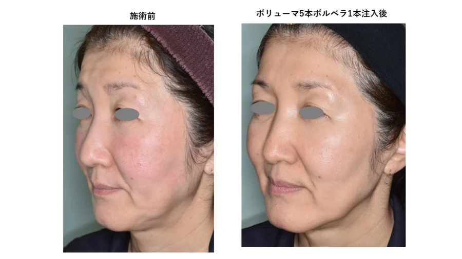 2a831ec055ed4fee4e1d0936ea4050