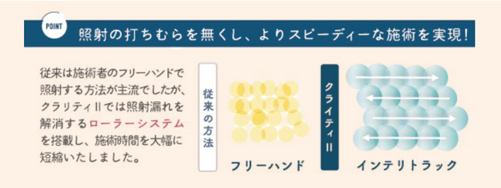 クラリティIIのポイント
