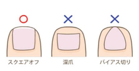 RCCラジオ《まるっと日常ワイド えんまん。》に出演しました:爪の健康について